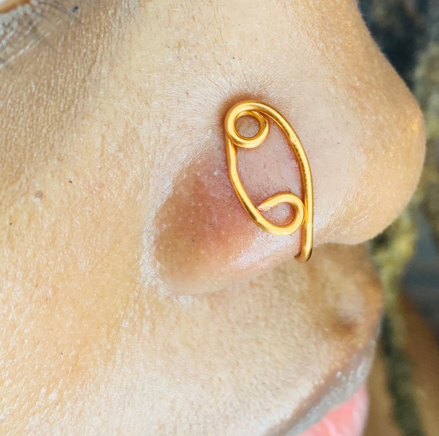 Cancer Nose Lace